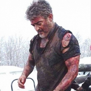 Actor Ajith’s shoulder injury after Vivegam said to have had a successful surgery done.
