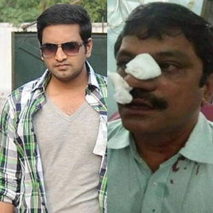 Actor Santhanam injured after a fistfight over a financial deal